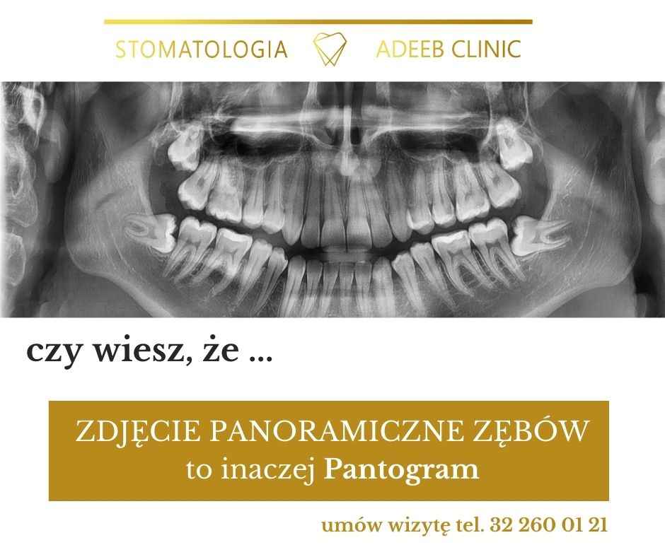 ADEEB CLINIC  DĄBROWA GÓRNICZA ZDJĘCIE RTG PANAROMICZNE Dąbrowa Górnicza - zdjęcie 1