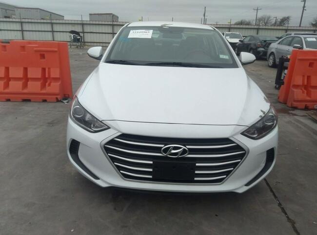 Hyundai Elantra 2018, 2.0L, SEL, po gradobiciu Warszawa - zdjęcie 2